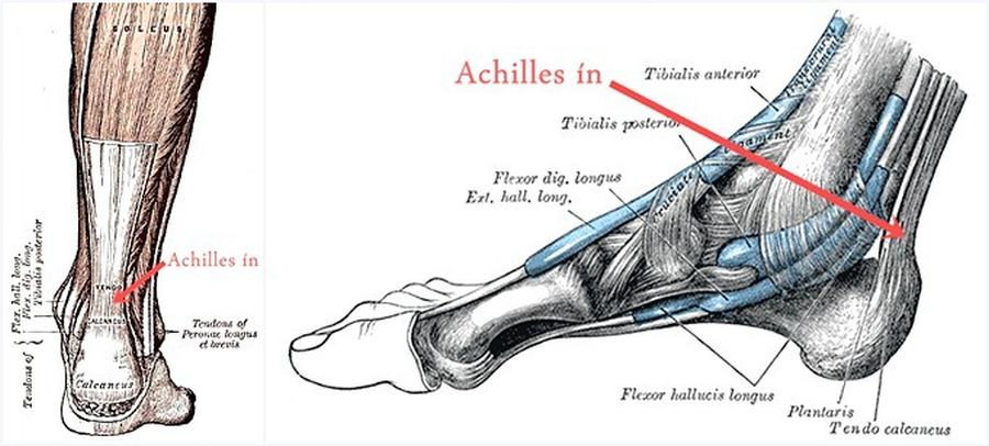 anatomy achilles tendon in pain fajdalom serules terepeuta